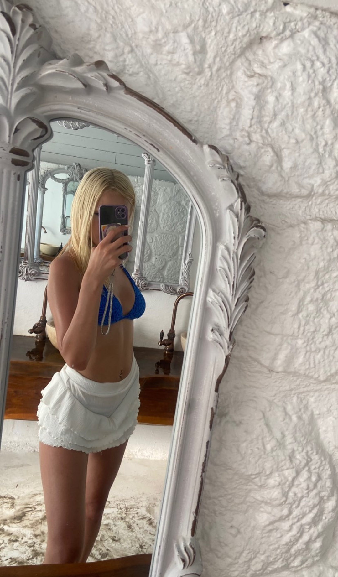 Bekilli Şaşırtıcı Kadın Escort Vildan